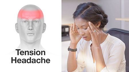 Chiropractic Treatment For Headaches