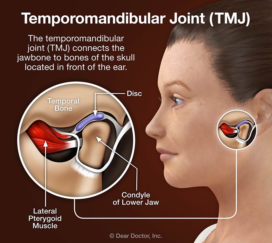 Tmj Disorders 8496